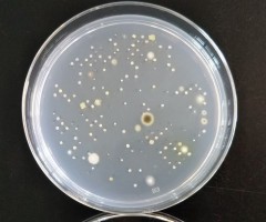 リビングカビと細菌