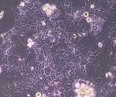 Caco-2細胞を顕微鏡で見た像